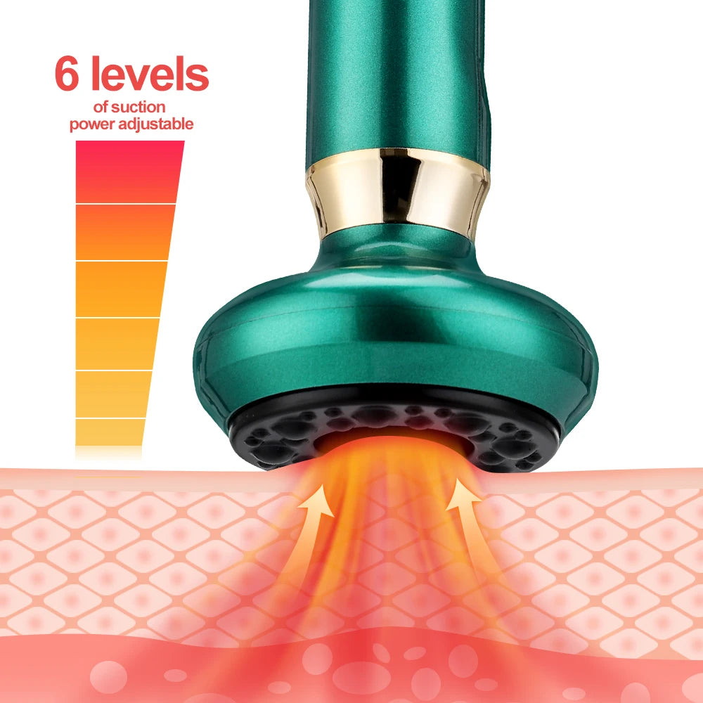 Smart Electric Cupping Massager with Heat & Gua Sha