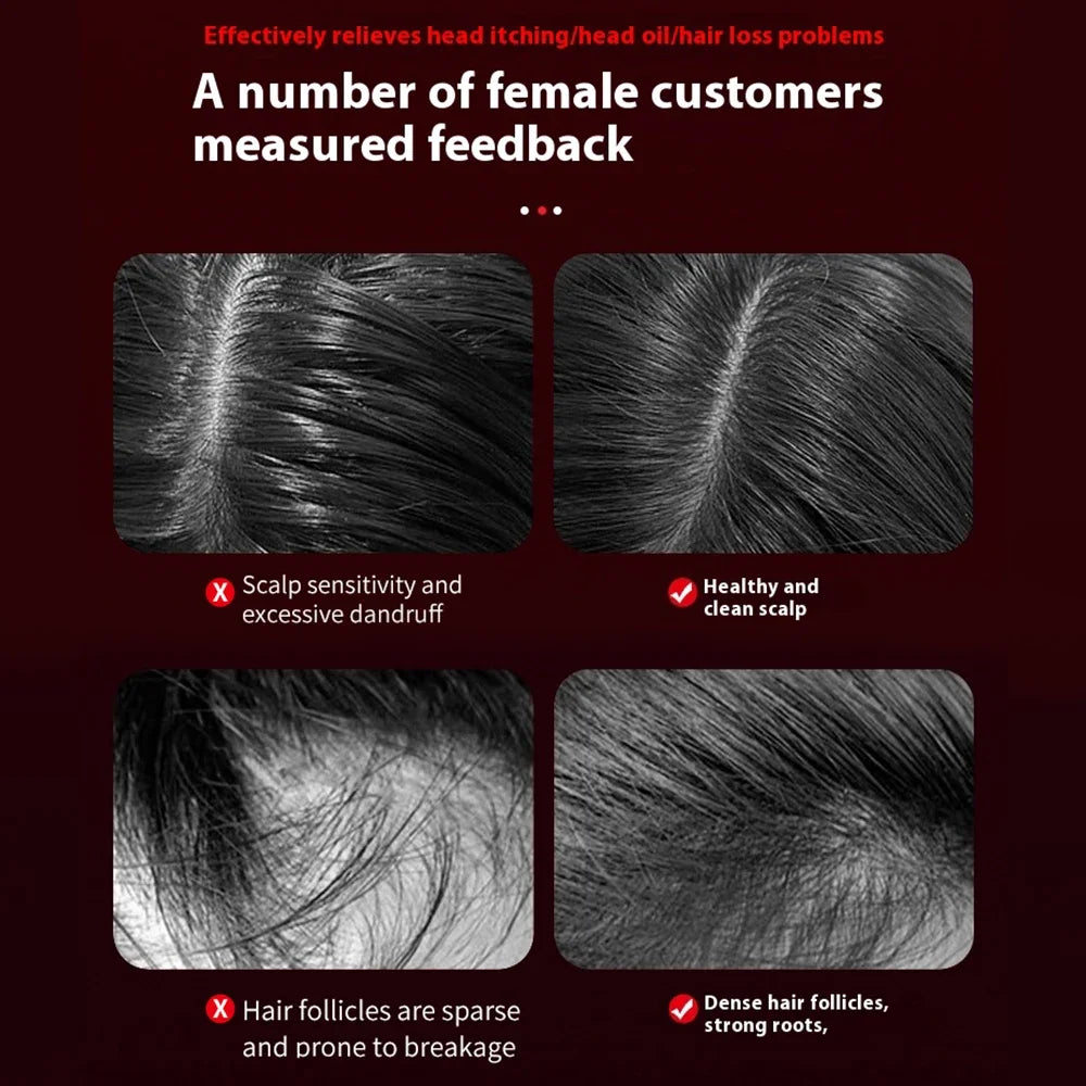 Laser Hair Growth Comb – 3-in-1 Therapy
